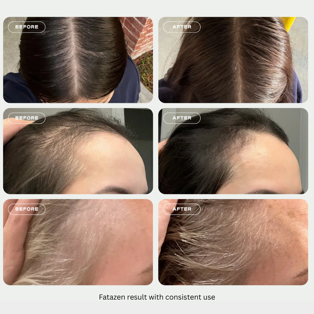 Multi-Peptide Serum for Hair Density